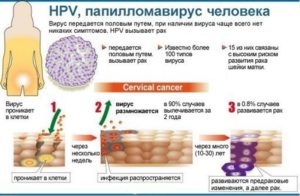 Как лечить вирус папилломы человека