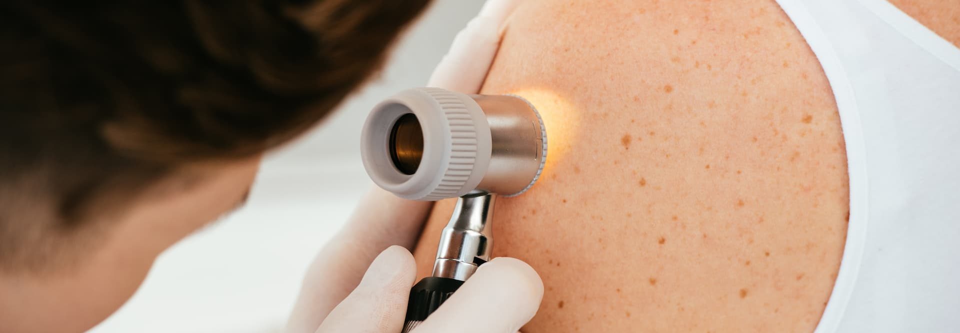 Выезд дерматолога на дом